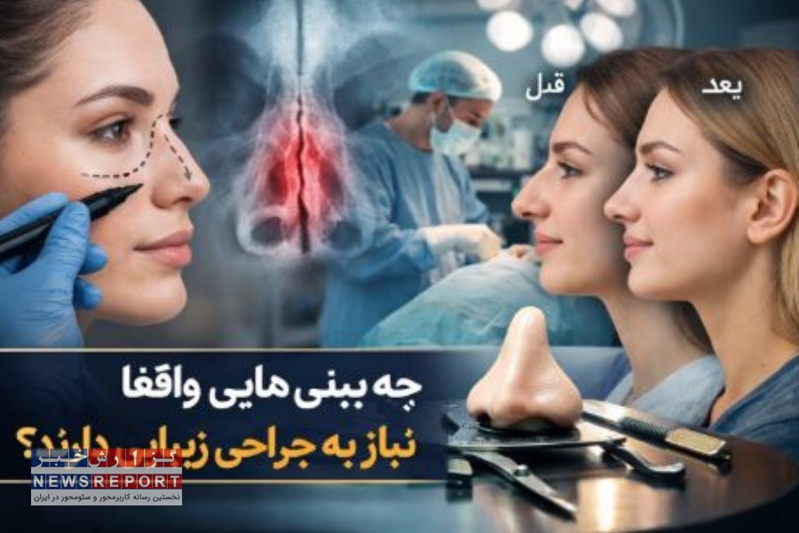 چه بینی‌هایی واقعاً نیاز به جراحی زیبایی دارند؟